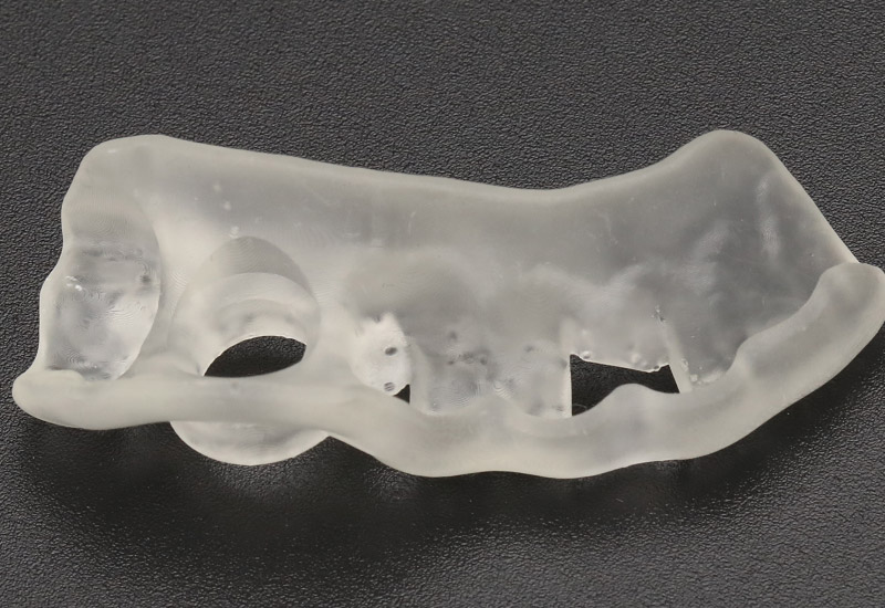 齒科3d打印機(jī)在齒科手術(shù)導(dǎo)板中的應(yīng)用介紹